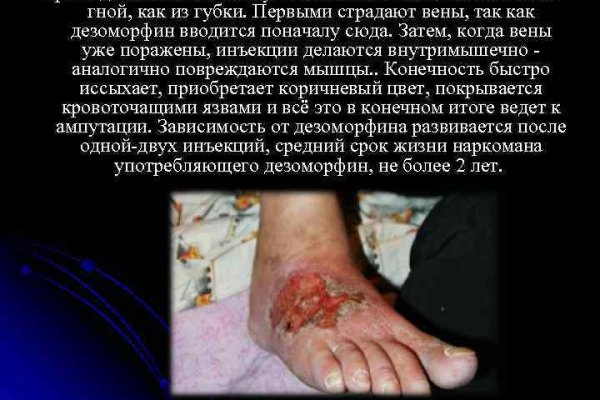 Сайт наркотиков купить